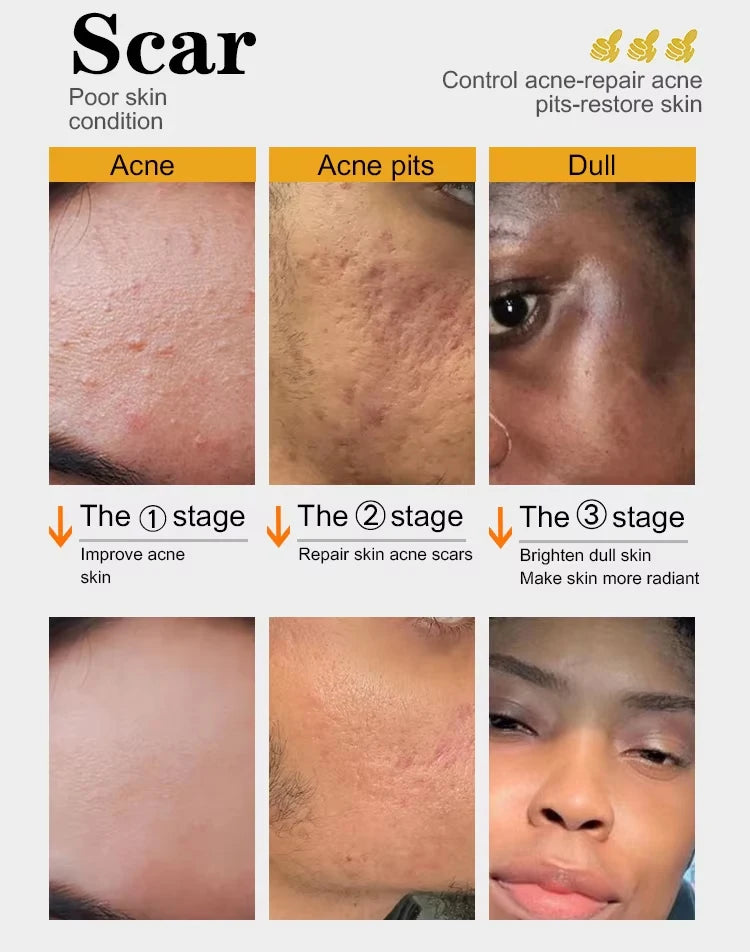 Organic Turmeric Skin Care Kit, Brighten, Remove Darkness, Lighten, Hydration, Exfoliate, Even Skin Tone, for Private Label
